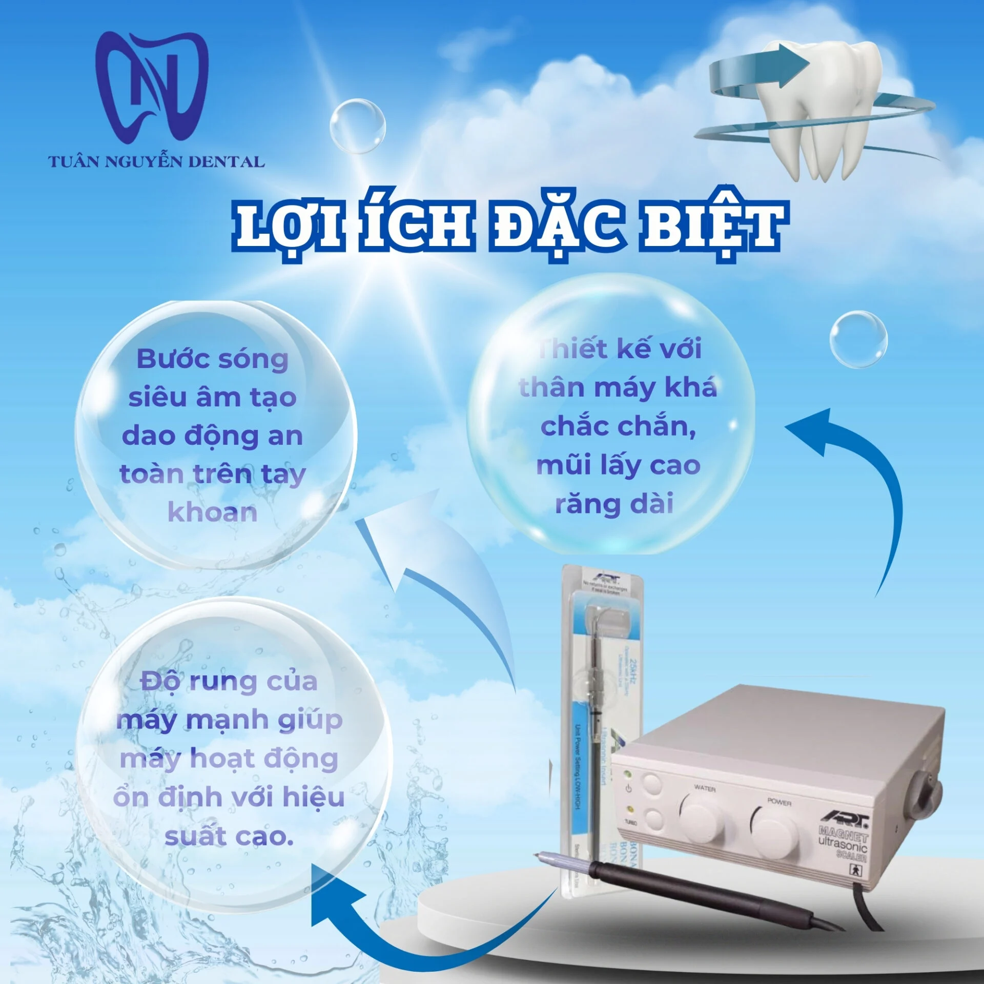 Lợi ích của máy lấy cao răng ART M1